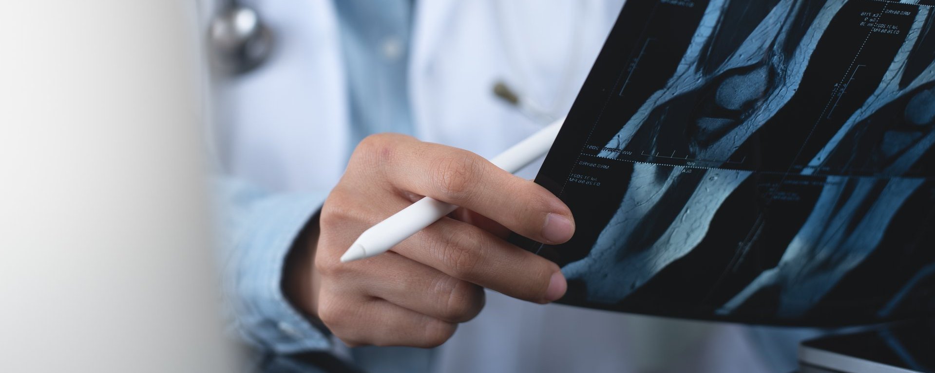 Ein Arzt hält ein Röntgenbild eines Knies in den Händen.