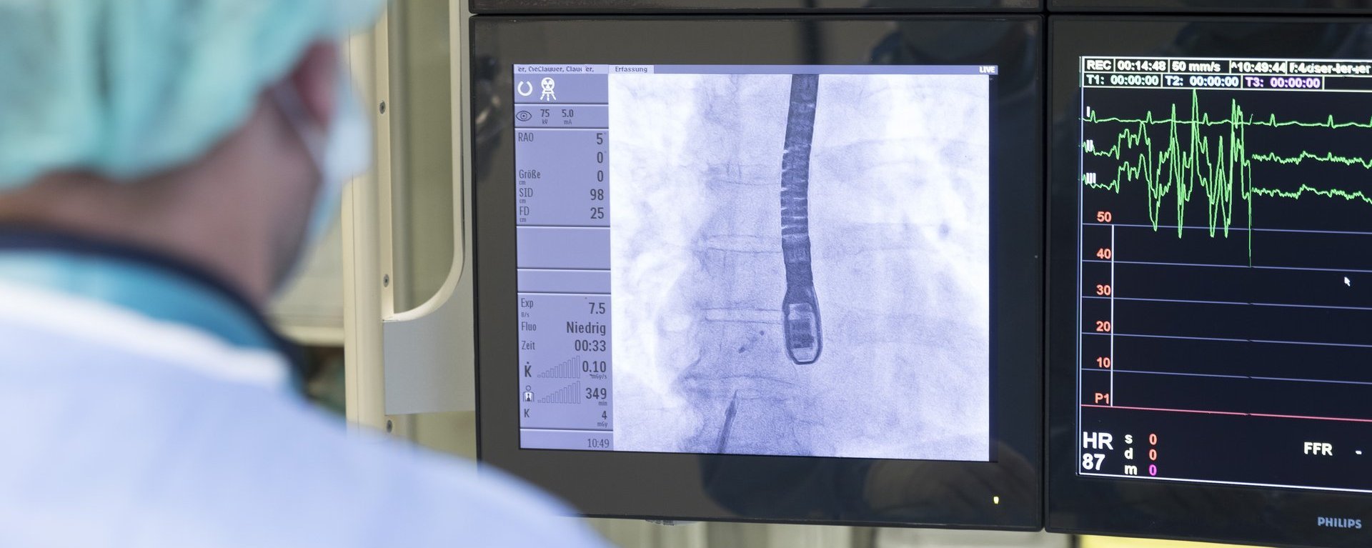 Ein Arzt schaut auf einige Monitore mit Werten und Aufnahmen des Herzens.