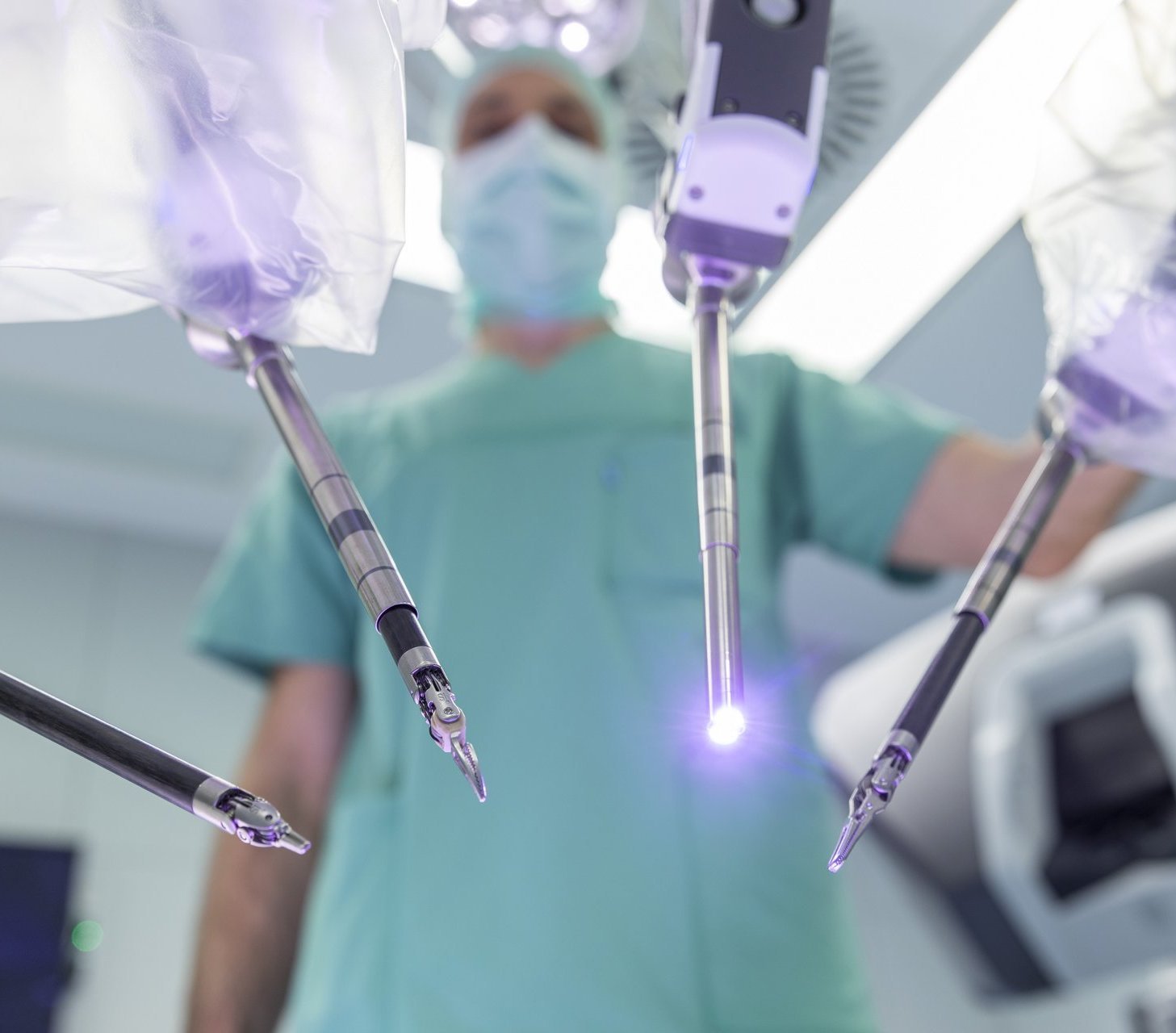 Blick auf die Instrumentenarme des Da-Vinci-Operationssystems im Einsatz bei einer minimalinvasiven Operation im AKH Celle.