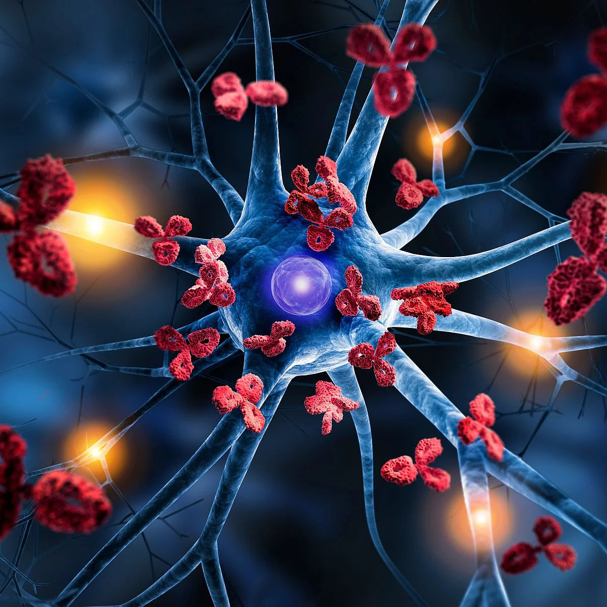 Illustration eines Nervenzellnetzwerks mit Antikörpern und Entzündungsreaktionen bei neuromuskulärer Erkrankung.