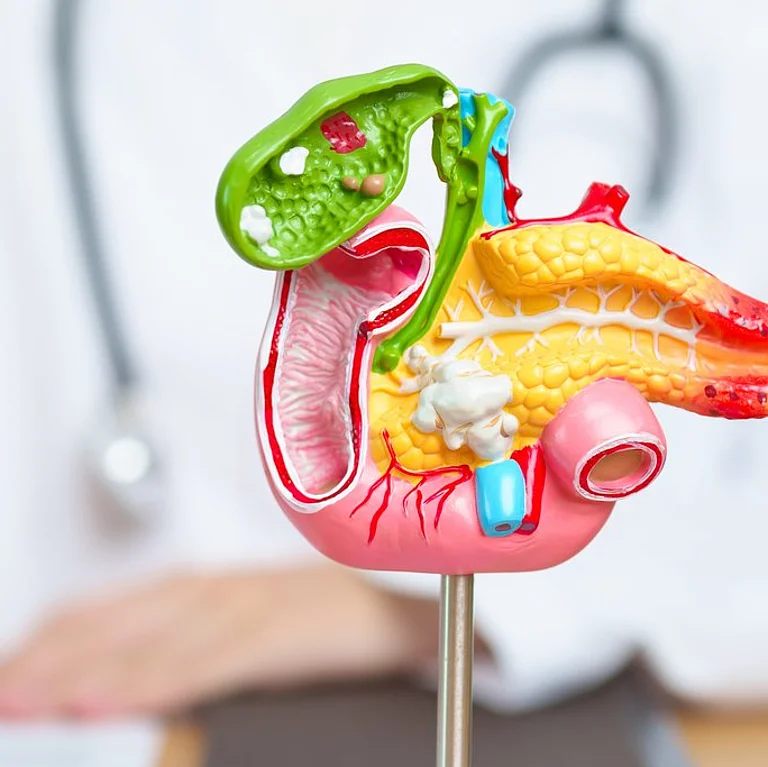 Modell einer menschlichen Bauchspeicheldrüse mit Gallenblase auf dem Schreibtisch eines Arztes in einem medizinischen Beratungsgespräch