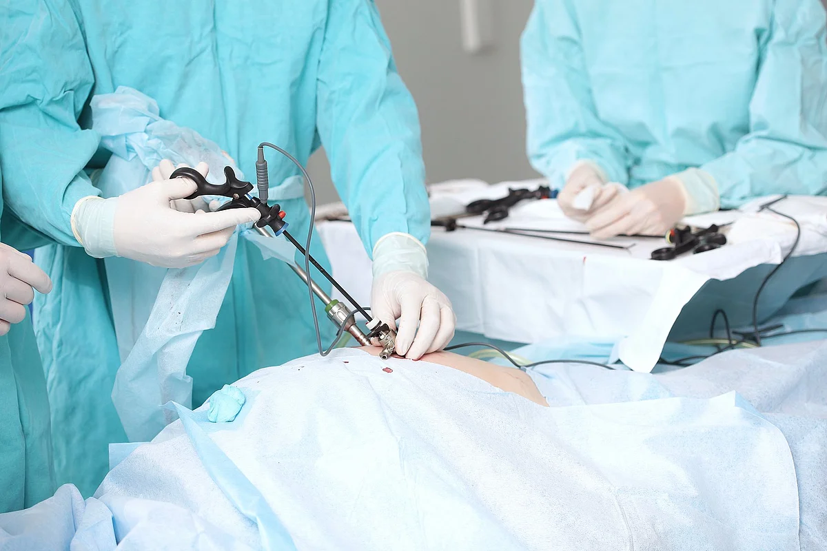 Das Bild zeigt eine minimalinvasive Operation, bei der Ärzt:innen laparoskopische Instrumente verwenden.