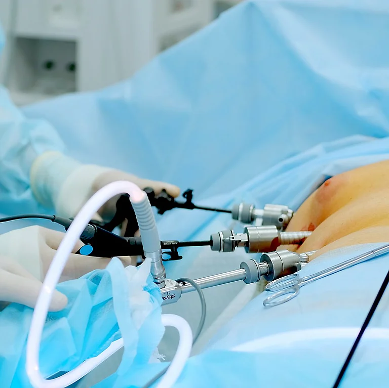Minimalinvasiver chirurgischer Eingriff am Uterus mit Laparoskopie-Instrumenten unter sterilen OP-Bedingungen.