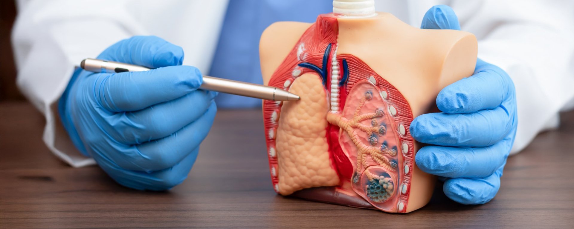 Ein Pneumologe erklärt Lungenerkrankungen anhand eines anatomischen Modells, das die Alveolen zeigt. Medizinische Konzepte von Lungenkrebs, pulmonaler alveolärer Proteinosis und Lungenschäden.